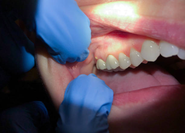 Best Emergency TMJ Treatment in Franklin, OH