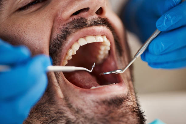 Best Emergency Gum Treatment in Franklin, OH