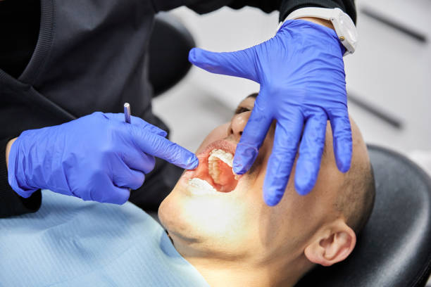 Best Emergency Dental Care for Broken or Chipped Teeth in Franklin, OH